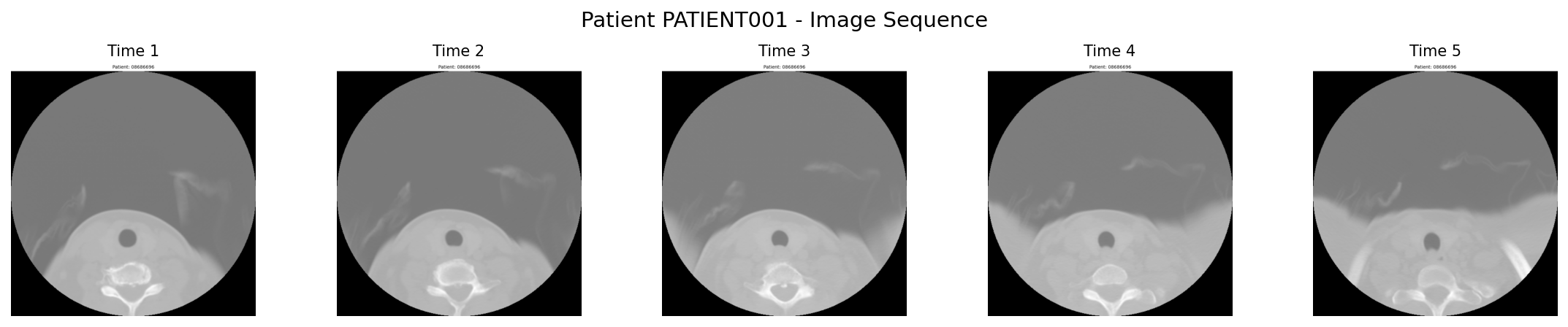 PATIENT001图像序列