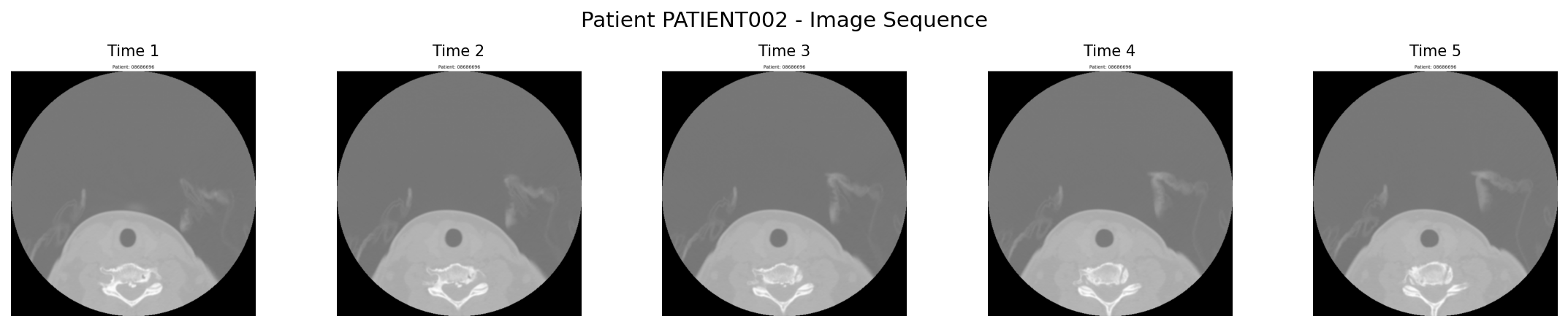 PATIENT002图像序列